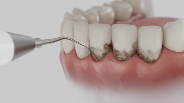 Trusted Root Canal Treatment service in Moss Bluff, LA - Dentist Open Now